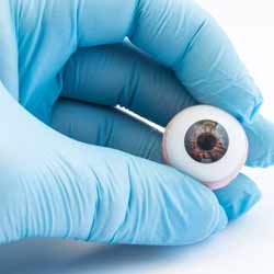 Ocularists Construct Prosthetic Eyes